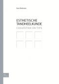 Voorkant - Esthetische Tandheelkunde