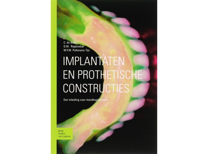 Voorkant - Implantaten en prothetische constructies