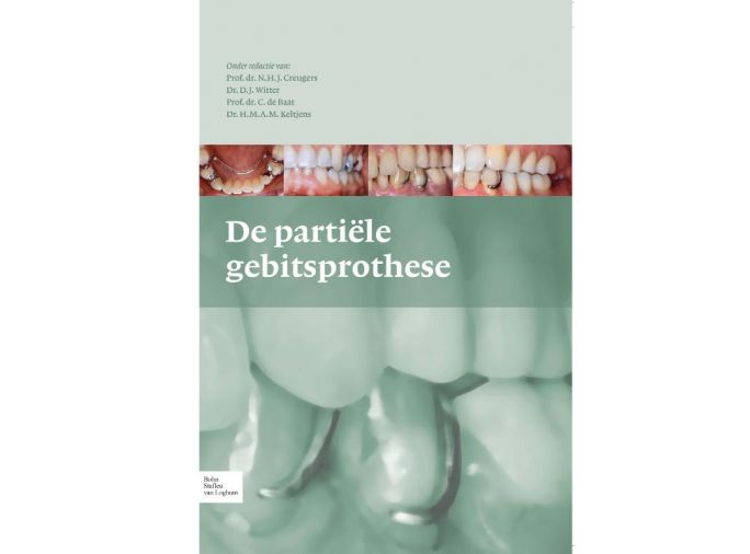Voorkant - De partiele gebitsprothese