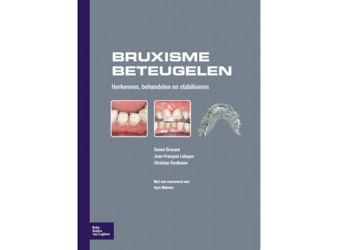 Voorkant - Bruxisme beteugelen