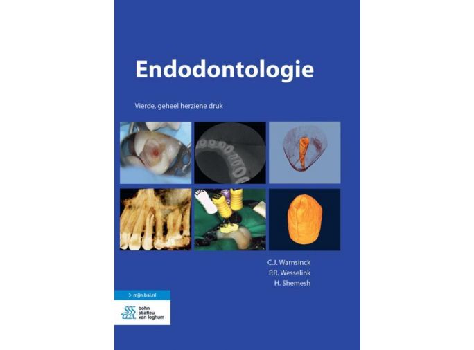 Voorkant - Endodontologie